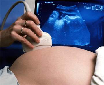 Lợi ích của các chẩn đoán trước sinh để phát hiện sớm dị tật ở thai nhi